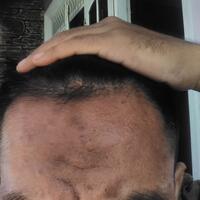 post-image
