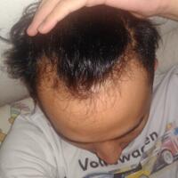 reborn-help-rambut-gua-rontok-hampir-botak