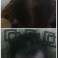 reborn-help-rambut-gua-rontok-hampir-botak