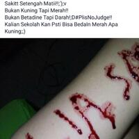 ketika-abg-alay-mau-drama-silet-tangan-tapi-fail