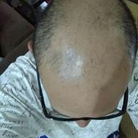 reborn-help-rambut-gua-rontok-hampir-botak