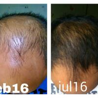 reborn-help-rambut-gua-rontok-hampir-botak
