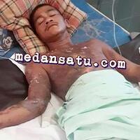 tragis-diikat-dipohon-ucok-dibakar-hidup-hidup-kepalanya-disabeti-rantai-anjing