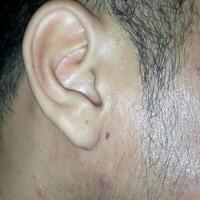 group-brewok-quotbrengozerquot-forum-resmi-berbagi-informasi-progress-hair-facial