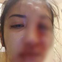 cewek-cantik-babak-belur-viral-di-medsos-polisi-tahan-kekasih