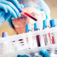 imunoterapi-cara-baru-melawan-kanker