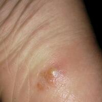 new-klinik-konsultasi-online-seputar-kesehatan-dan-penyakit