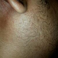 group-brewok-quotbrengozerquot-forum-resmi-berbagi-informasi-progress-hair-facial---part-1