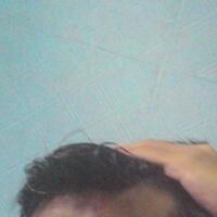 reborn-help-rambut-gua-rontok-hampir-botak