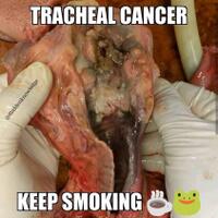 tracheal-cancer