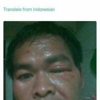 kader-pdip-dikeroyok-10-orang-di-jakarta-barat