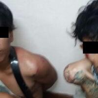 korban-jambret-terpentak-ke-aspal-alami-pergeseran-bahu