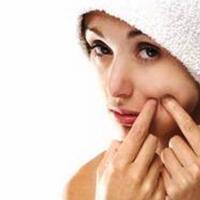 kebiasaan-buruk-ini-picu-munculnya-jerawat-pada-wajah