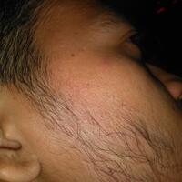 group-brewok-quotbrengozerquot-forum-resmi-berbagi-informasi-progress-hair-facial---part-1