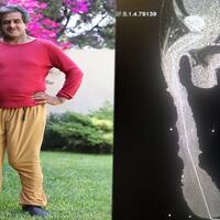 kisah-unik-kehidupan-seks-pemilik-organ-intim-terbesar-di-dunia-pacarnya-tak-sanggup