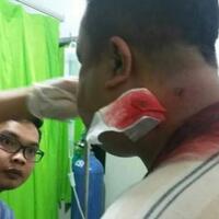 leher-pns-pagaralam-ditembak-perampok-yang-merental-mobilnya