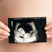 perlukah-tes-genetika-untuk-janin