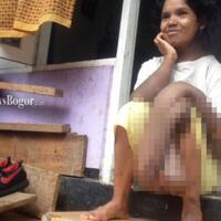 perempuan-ini-rasakan-tangannya-gatal-4-tahun-dibiarkan-malah-seperti-ini