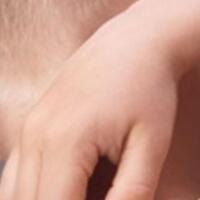 bu-jangan-asal-mengobati-kenali-alergi-pada-anak-dari-gejalanya