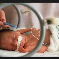 bayi-prematur-penyumbang-terbesar-angka-kematian-bayi