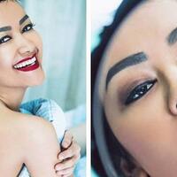 wajah-pucat-jupe-berubah-bibirnya-merah-merona-saat-jalani-pemotretan-di-rumah-sakit