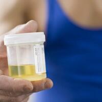 anda-sebaiknya-waspada-jika-warna-urine-berubah-jadi-merah