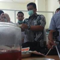 bayi-yang-membatu-selama-37-tahun-diangkat-dari-dalam-rahim