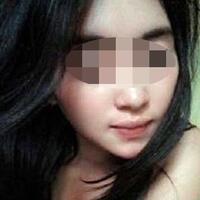 mantan-pacar-siramkan-air-keras-ke-wajah-pemandu-lagu-asal-mojokerto