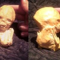 fenomena-lithopedion-bayi-membatu-hingga-37-tahun-dalam-perut-ibu-berumur-60-tahun