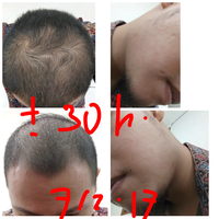 group-brewok-quotbrengozerquot-forum-resmi-berbagi-informasi-progress-hair-facial---part-1