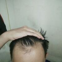 reborn-help-rambut-gua-rontok-hampir-botak