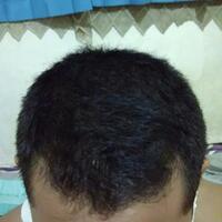 reborn-help-rambut-gua-rontok-hampir-botak