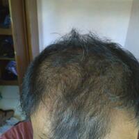 post-image
