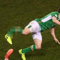 fifa-tanggung-semua-biaya-pemulihan-seamus-coleman