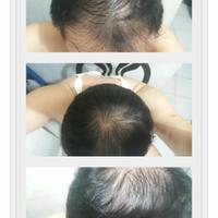 post-image