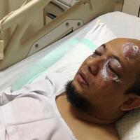 novel-baswedan-dari-tangani-kasus-burung-walet-sampai-e-ktp