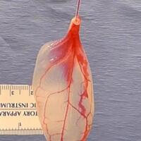 ilmuwan-sukses-ubah-daun-bayam-jadi-jantung-tiruan