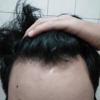 post-image