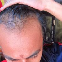 reborn-help-rambut-gua-rontok-hampir-botak