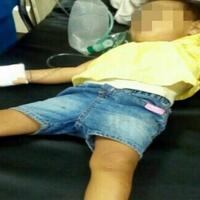 kesal-anak-majikan-rewel-smm-gigit-kuping-dan-colok-mata-korban-dengan-kuku