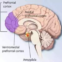 seperti-inilah-gambaran-otak-seorang-ekstremis-agama