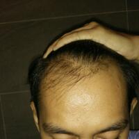 reborn-help-rambut-gua-rontok-hampir-botak