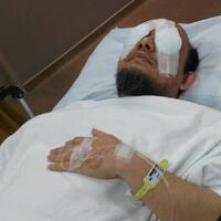 polisi-telusuri-penyerangan-dari-kasus-yang-ditangani-novel