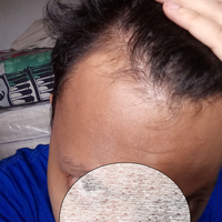 post-image