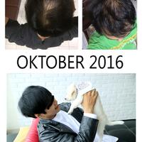 reborn-help-rambut-gua-rontok-hampir-botak