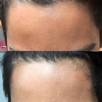 post-image