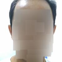 post-image