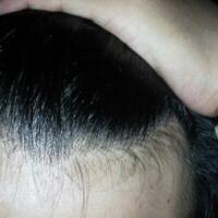 post-image
