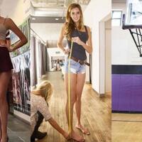 gadis-22-tahun-ini-punya-kaki-terpanjang-namun-ini-yang-membuatnya-susah