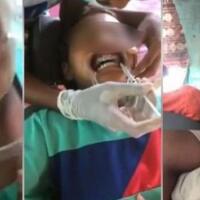 video-bocah-pasang-kawat-gigi-ini-viral-tapi-banjir-cacian-ini-sebabnya